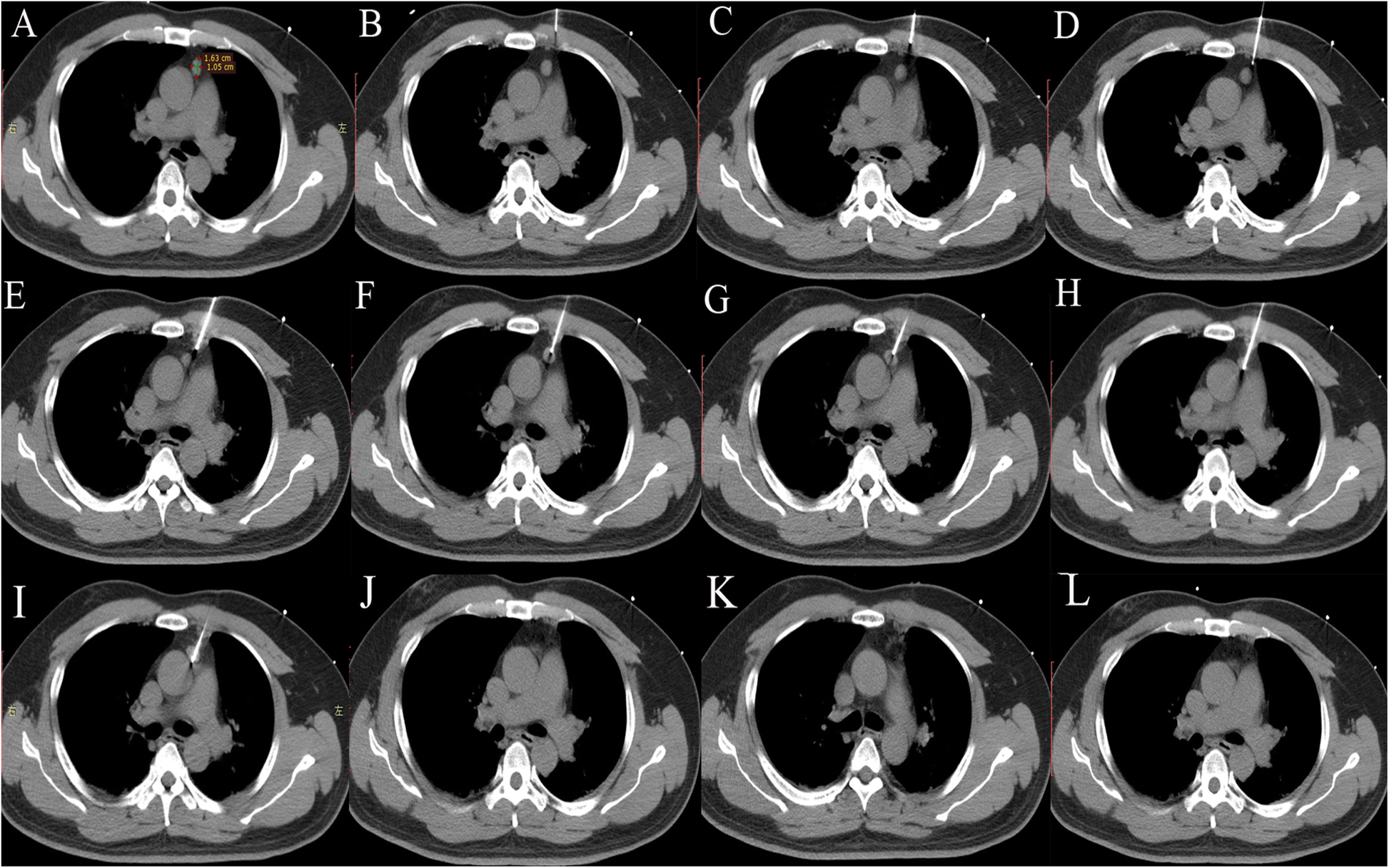 Fig. 2