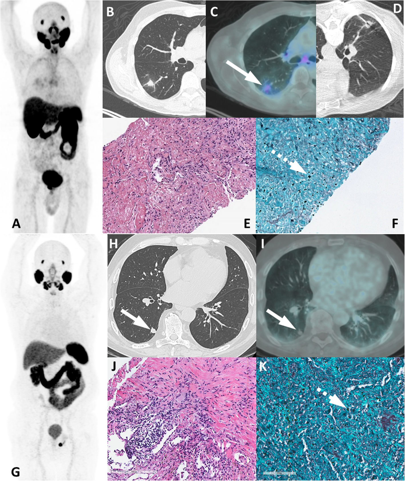 Fig. 11