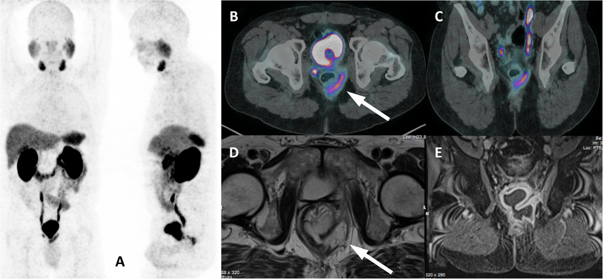 Fig. 12