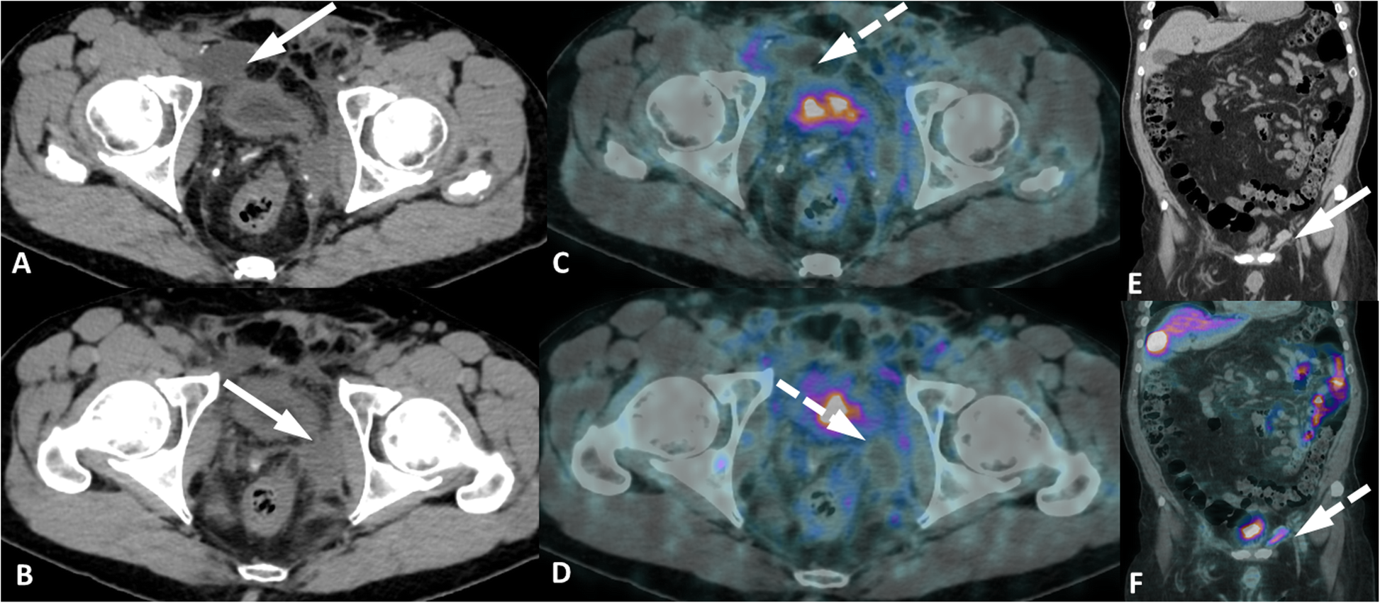 Fig. 14