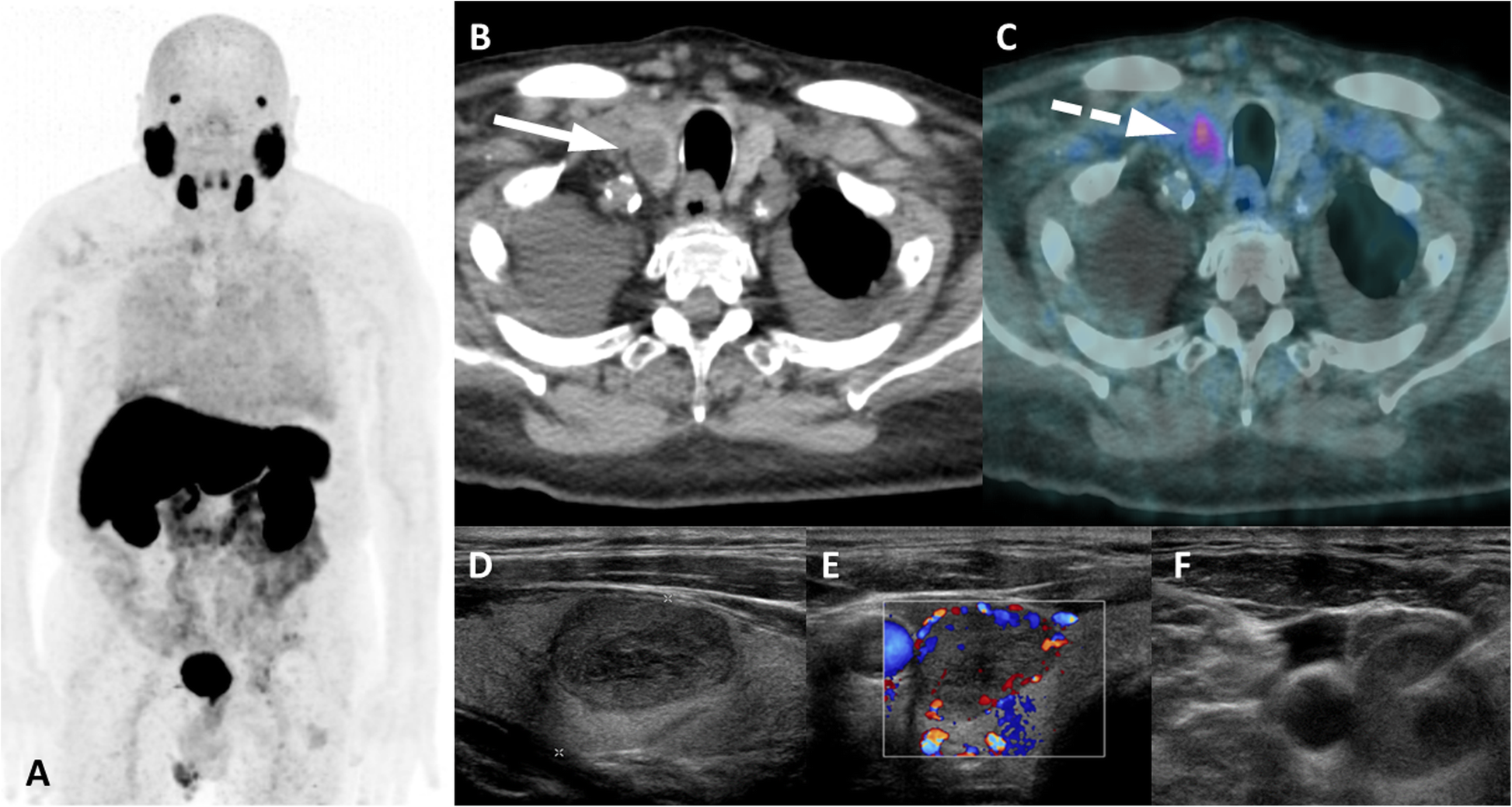 Fig. 15