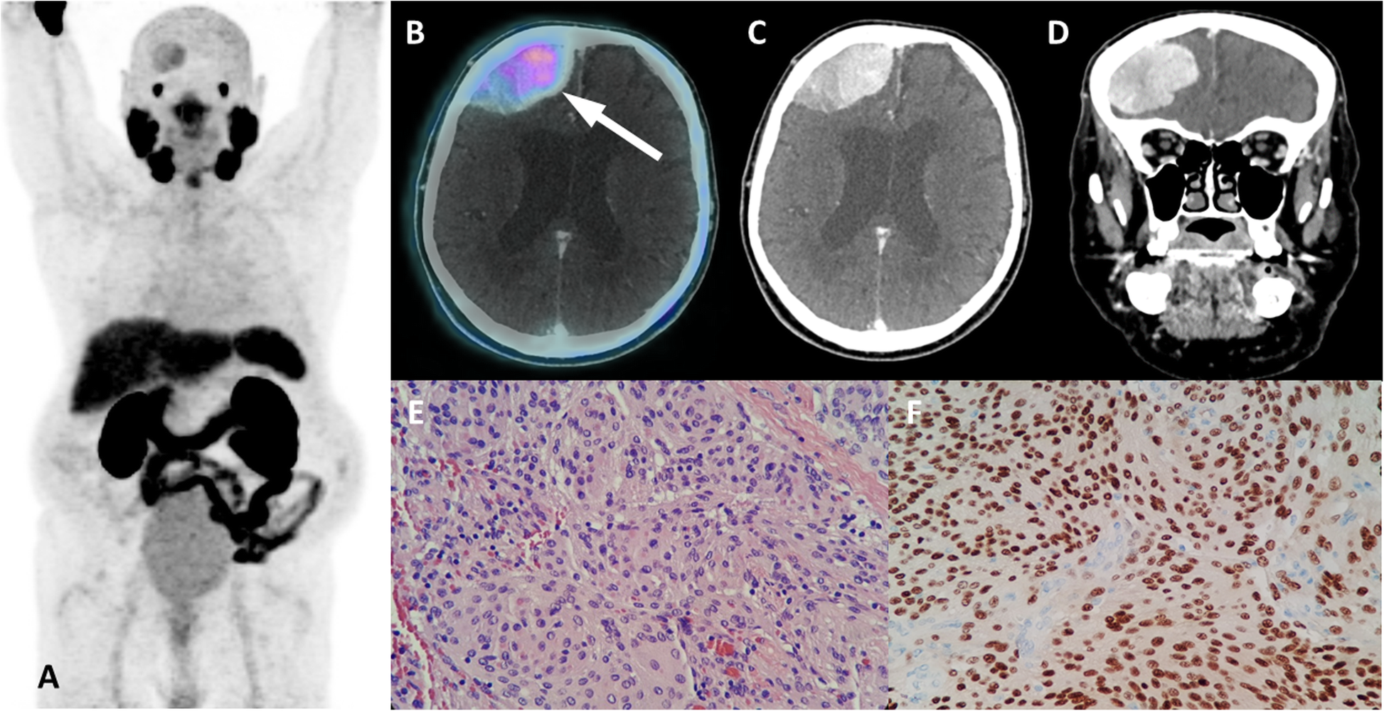 Fig. 17