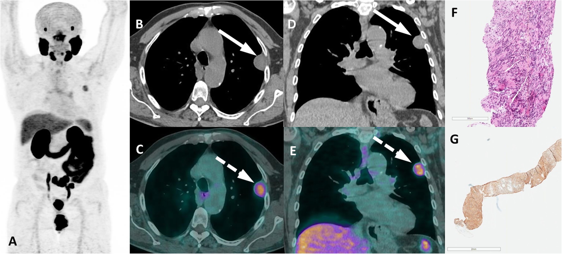 Fig. 18