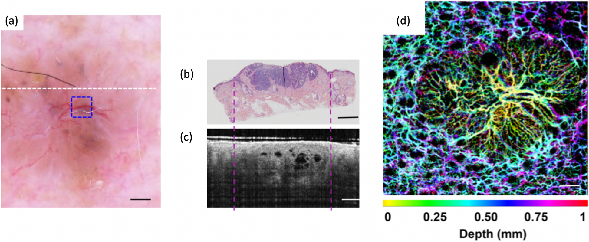 Fig. 19