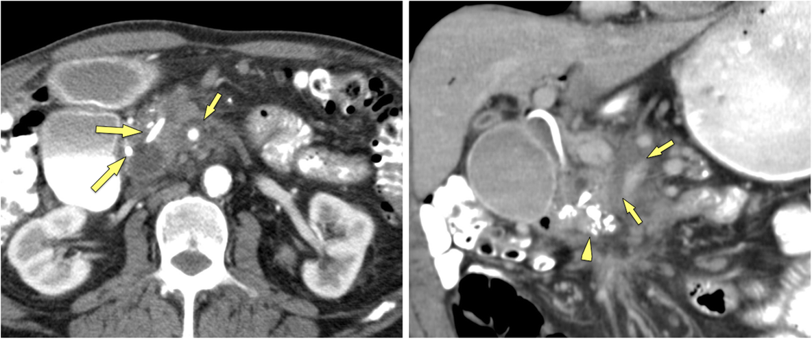 Fig. 10