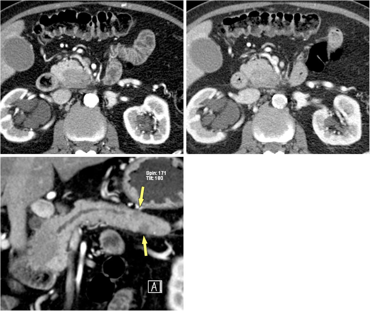 Fig. 11