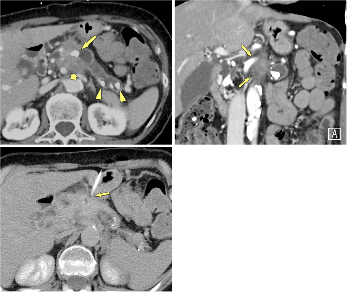 Fig. 6