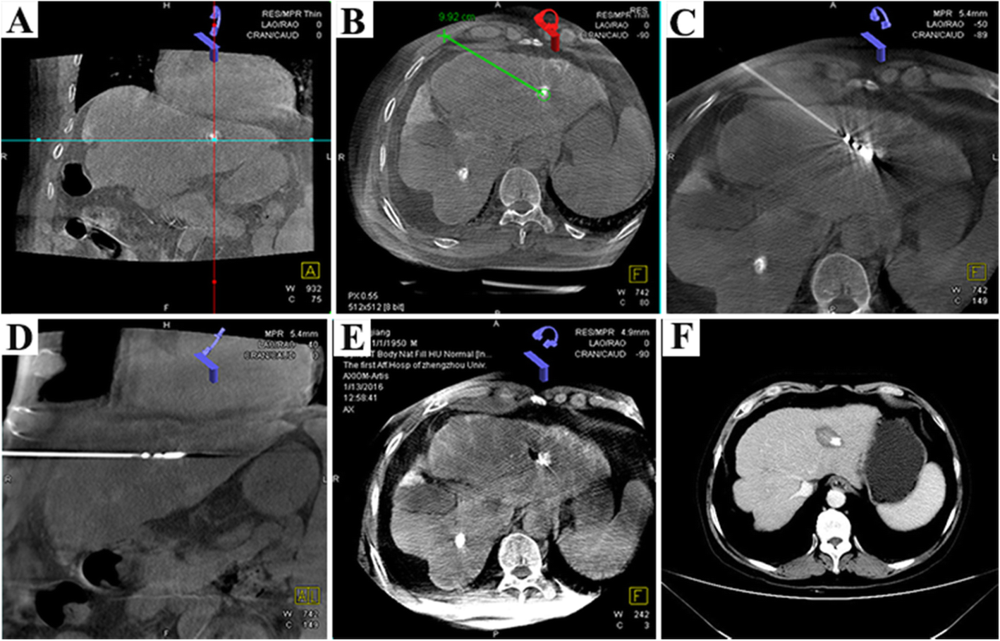 Fig. 2