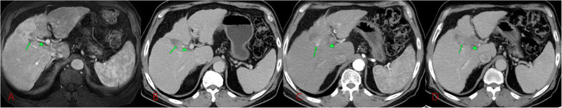 Fig. 6