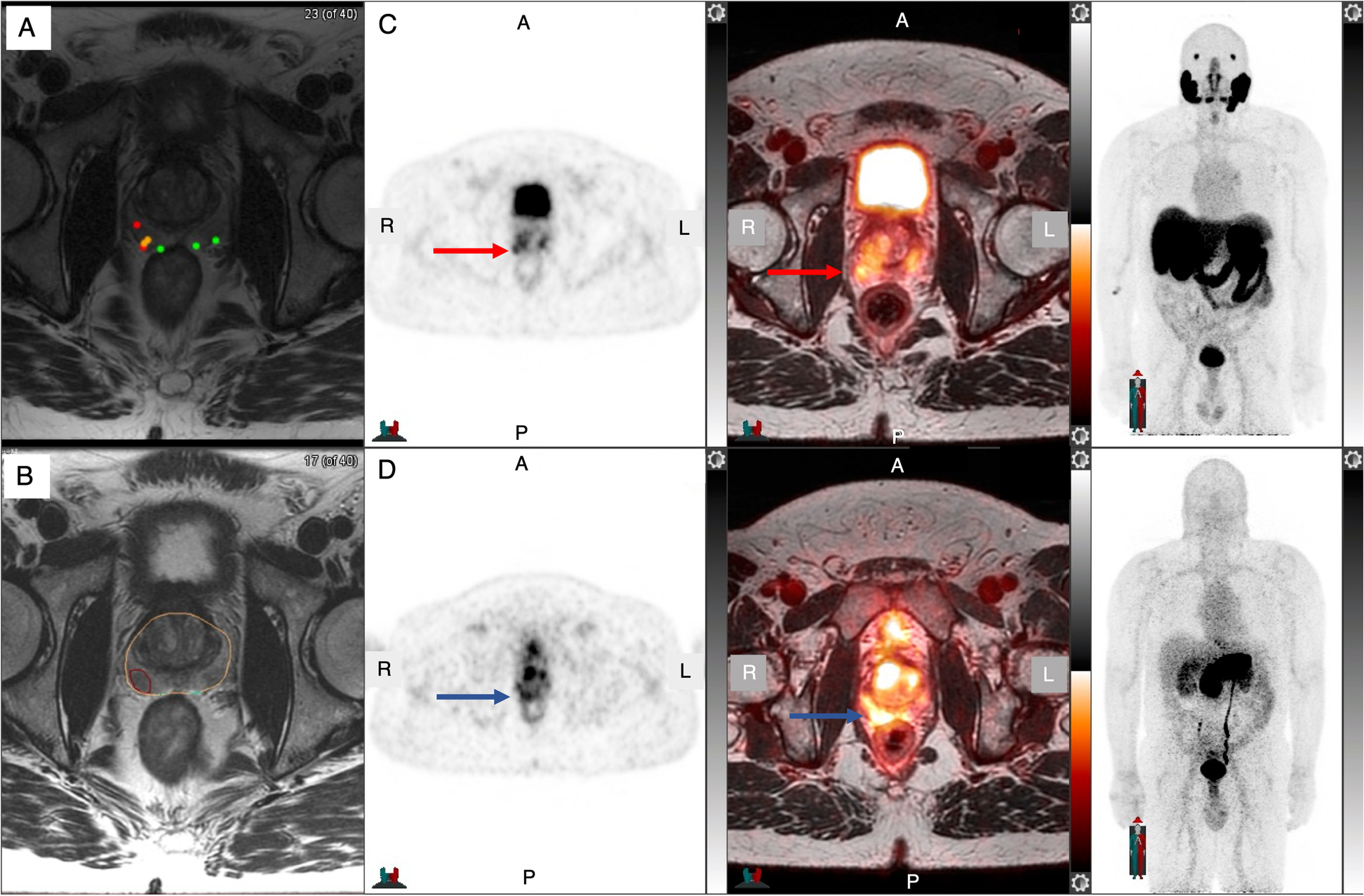 Fig. 2.