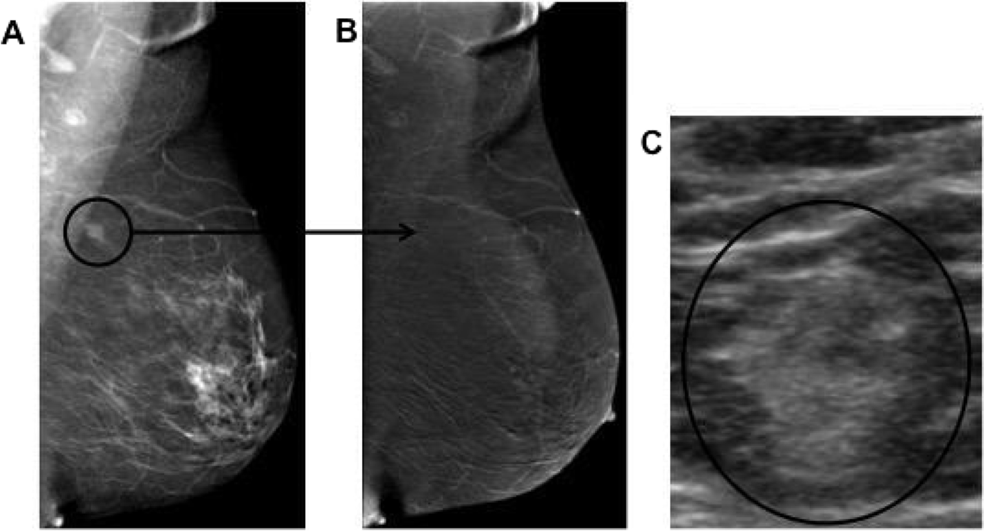 Fig. 11