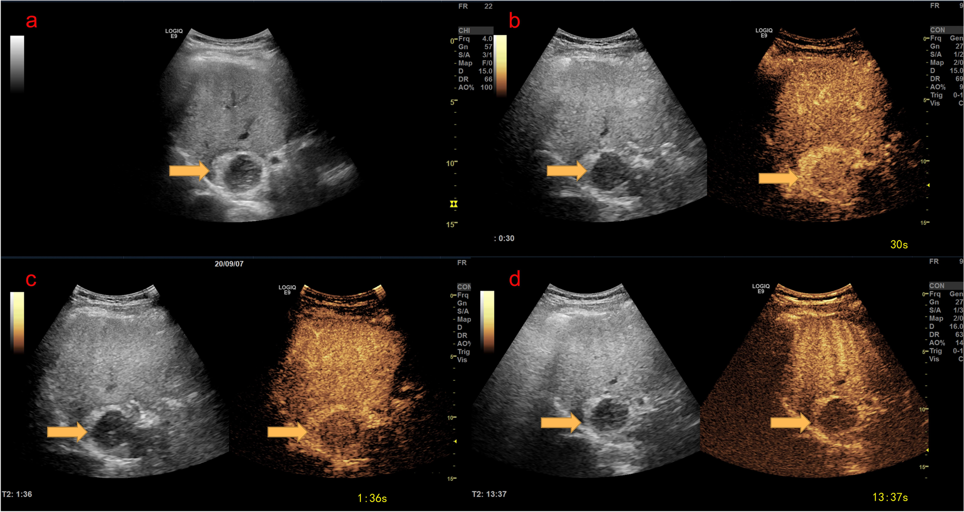 Fig. 4