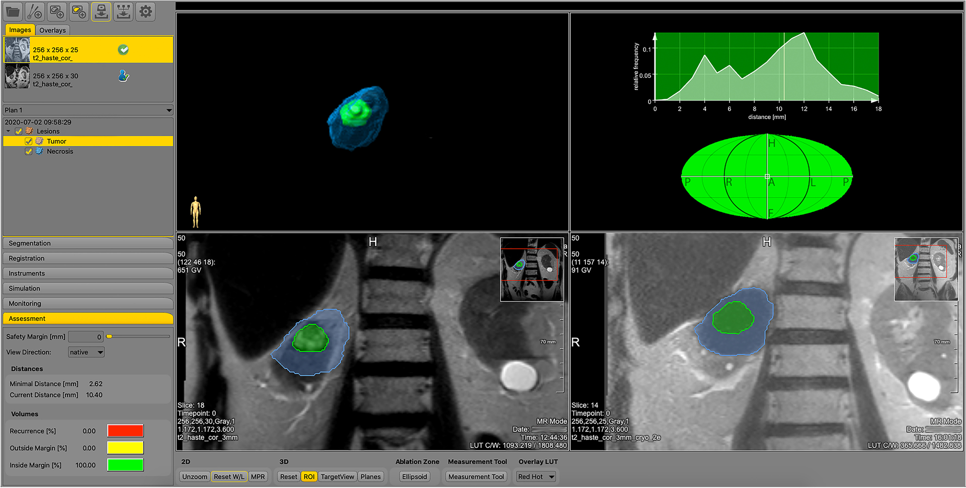 Fig. 2