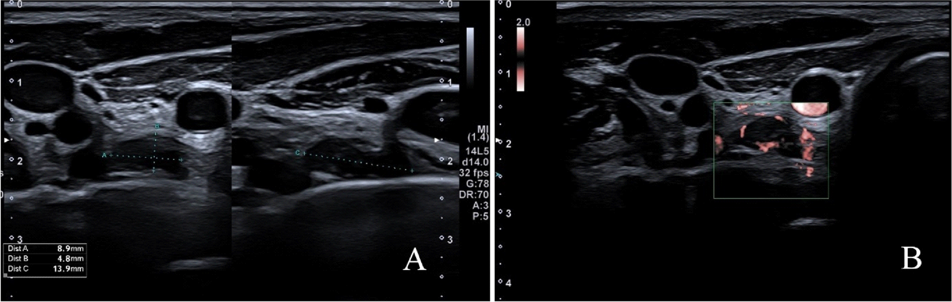 Fig. 3