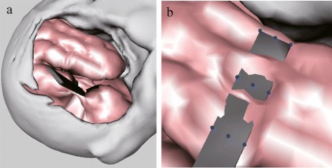 Figure 15