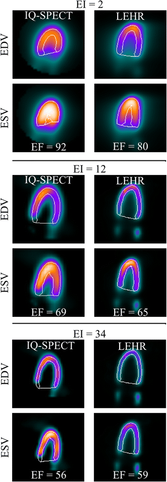 Fig. 4