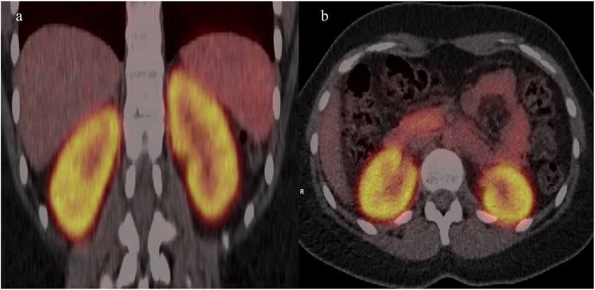 Fig. 9