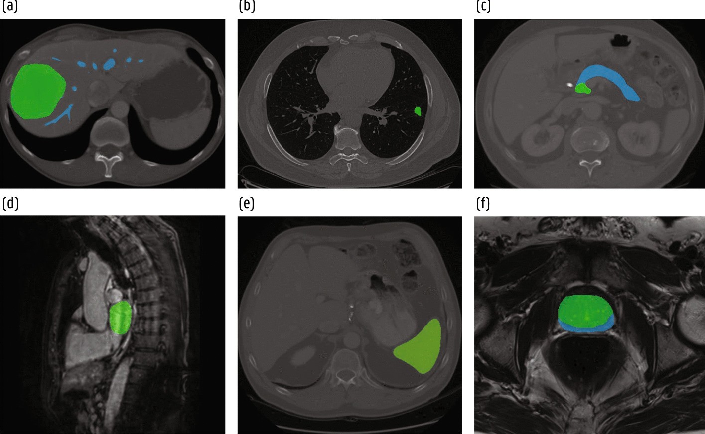 Fig. 15