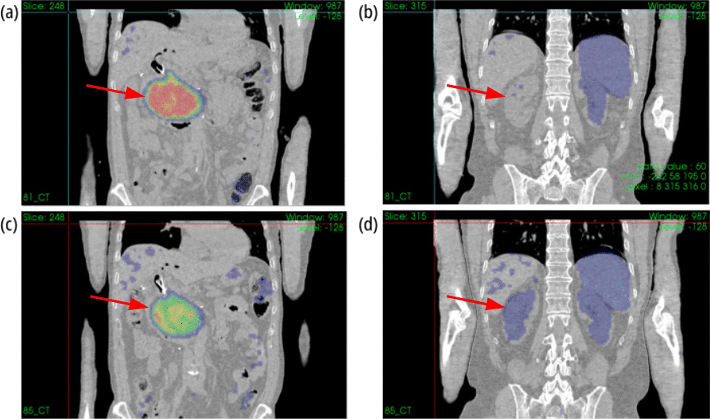 Fig. 10