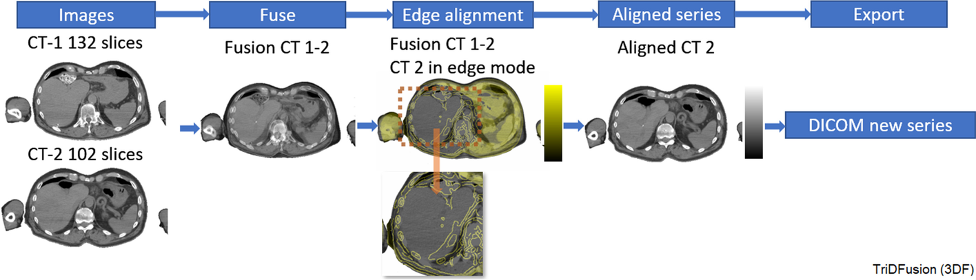 Fig. 11