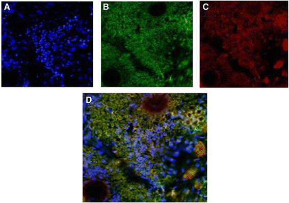 Figure 11