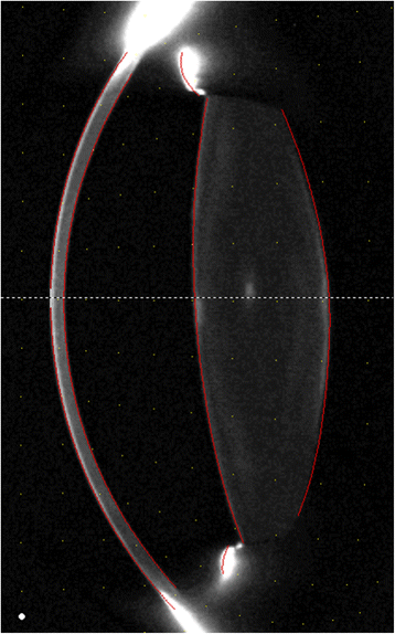 Fig. 2