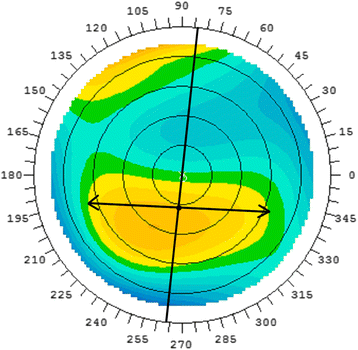 Fig. 2