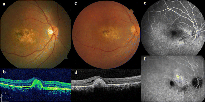 Fig. 2