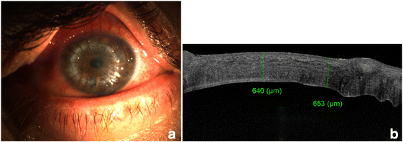 Fig. 3