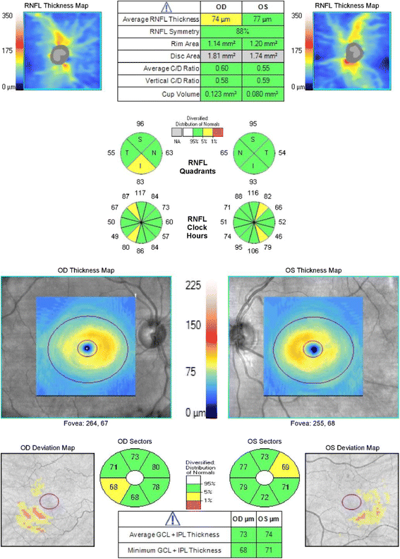 Fig. 4