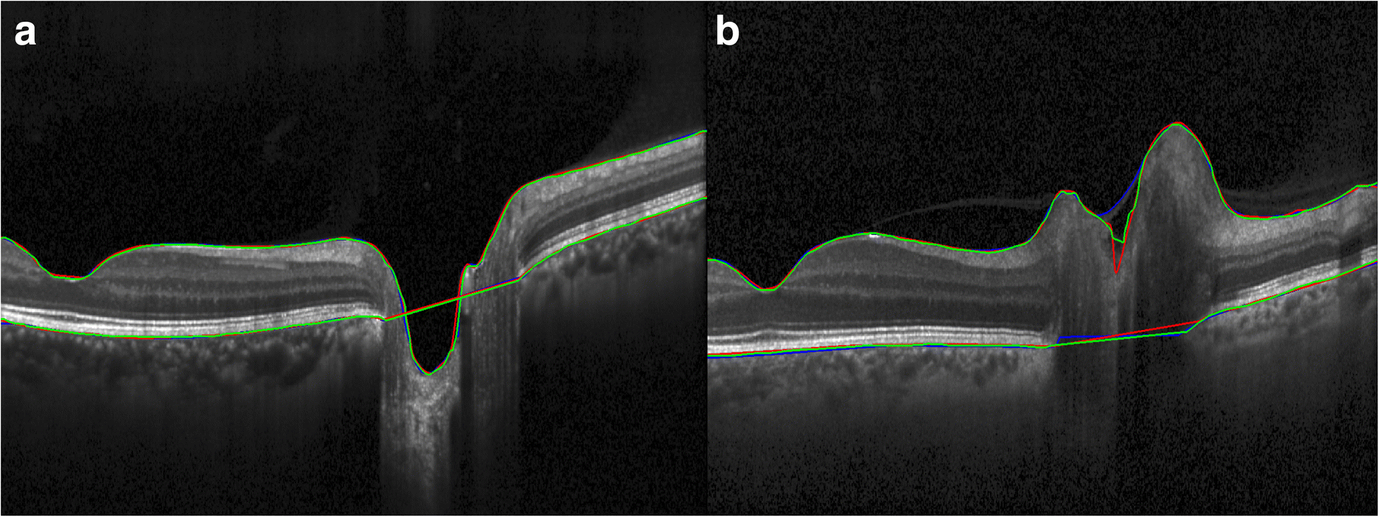 Fig. 4