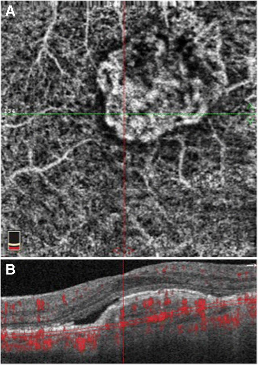 Fig. 3