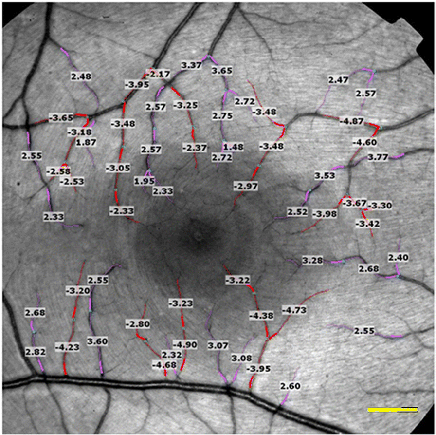 Fig. 1