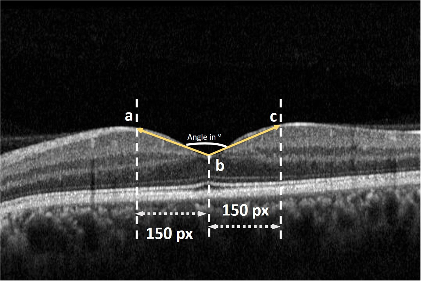 Fig. 2