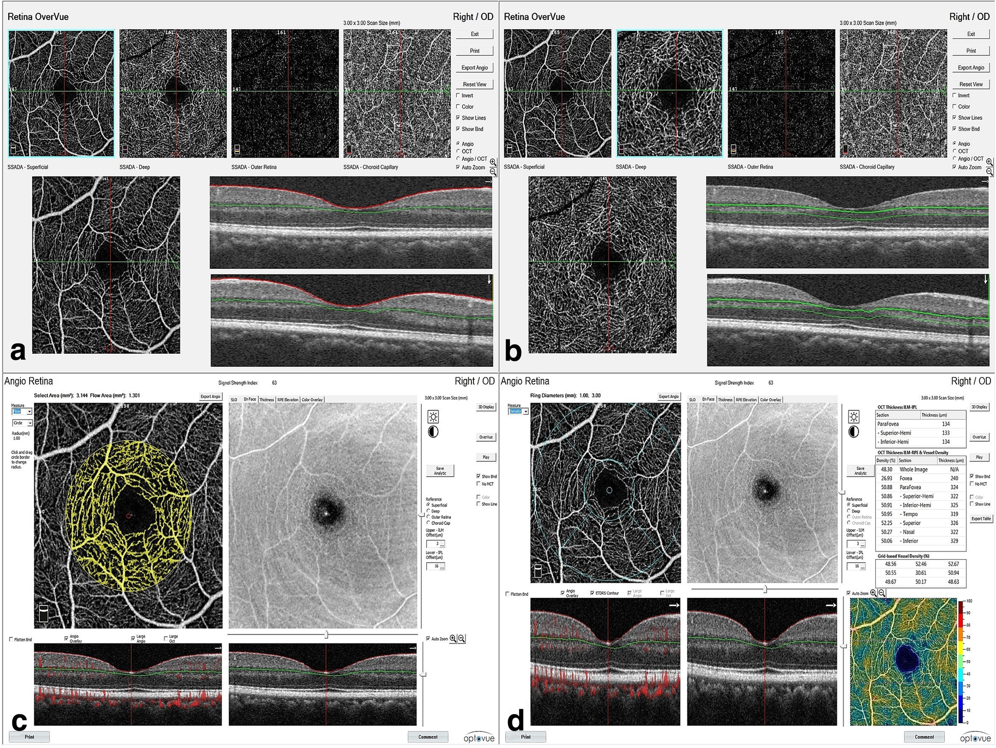 Fig. 3