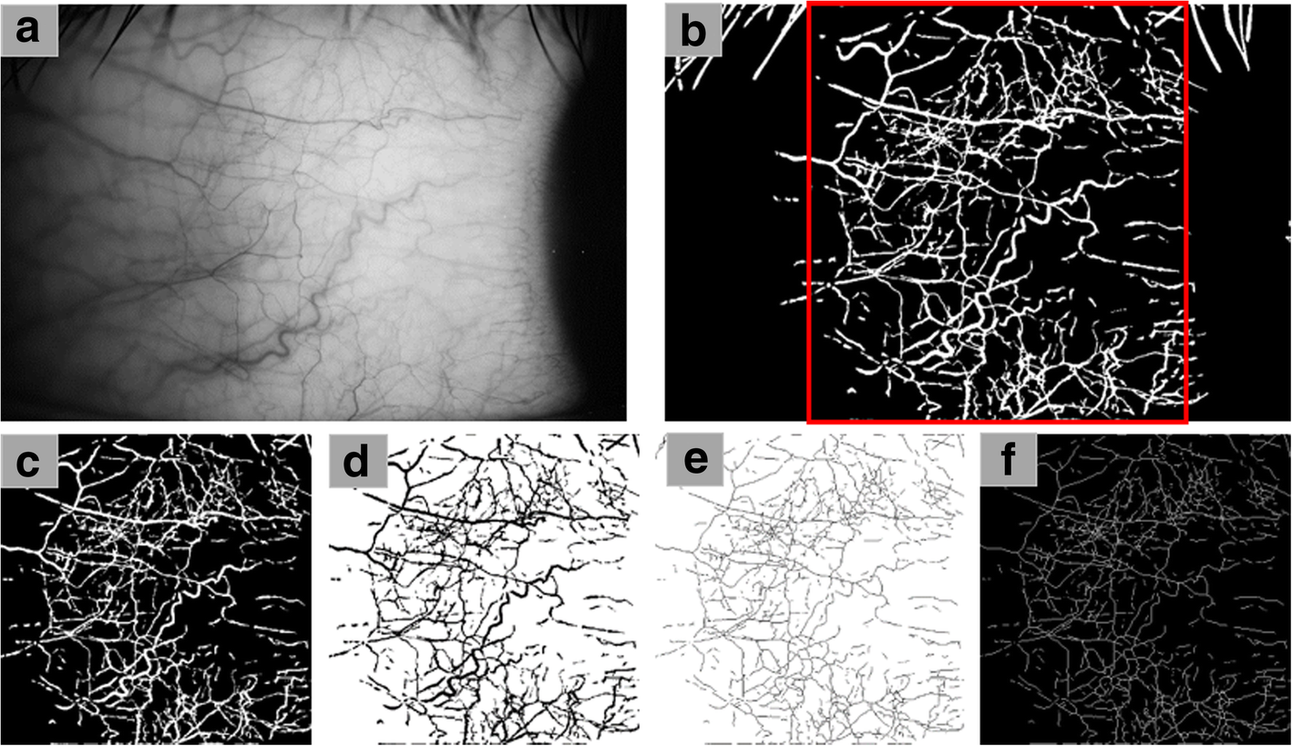 Fig. 4