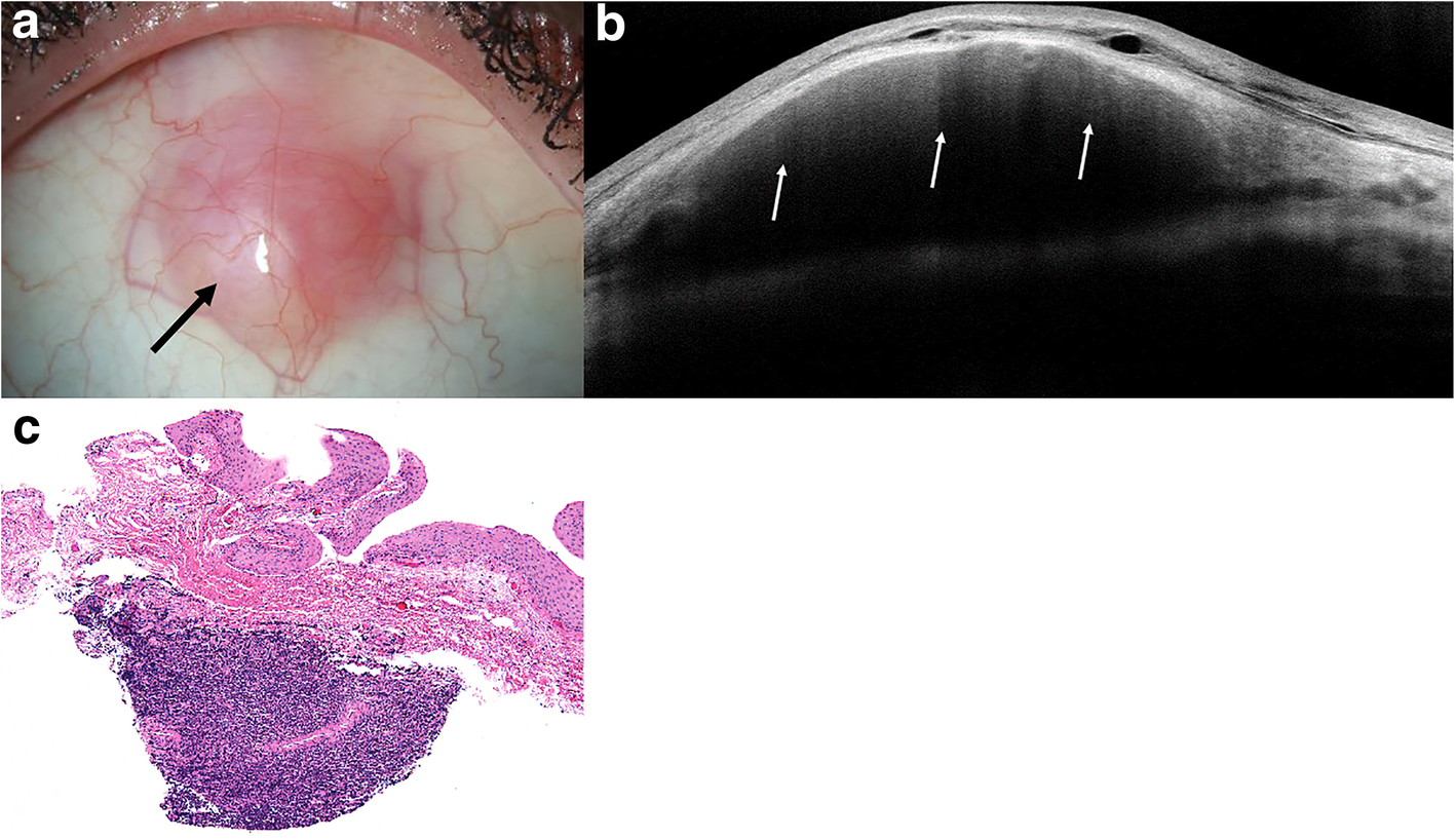 Fig. 6