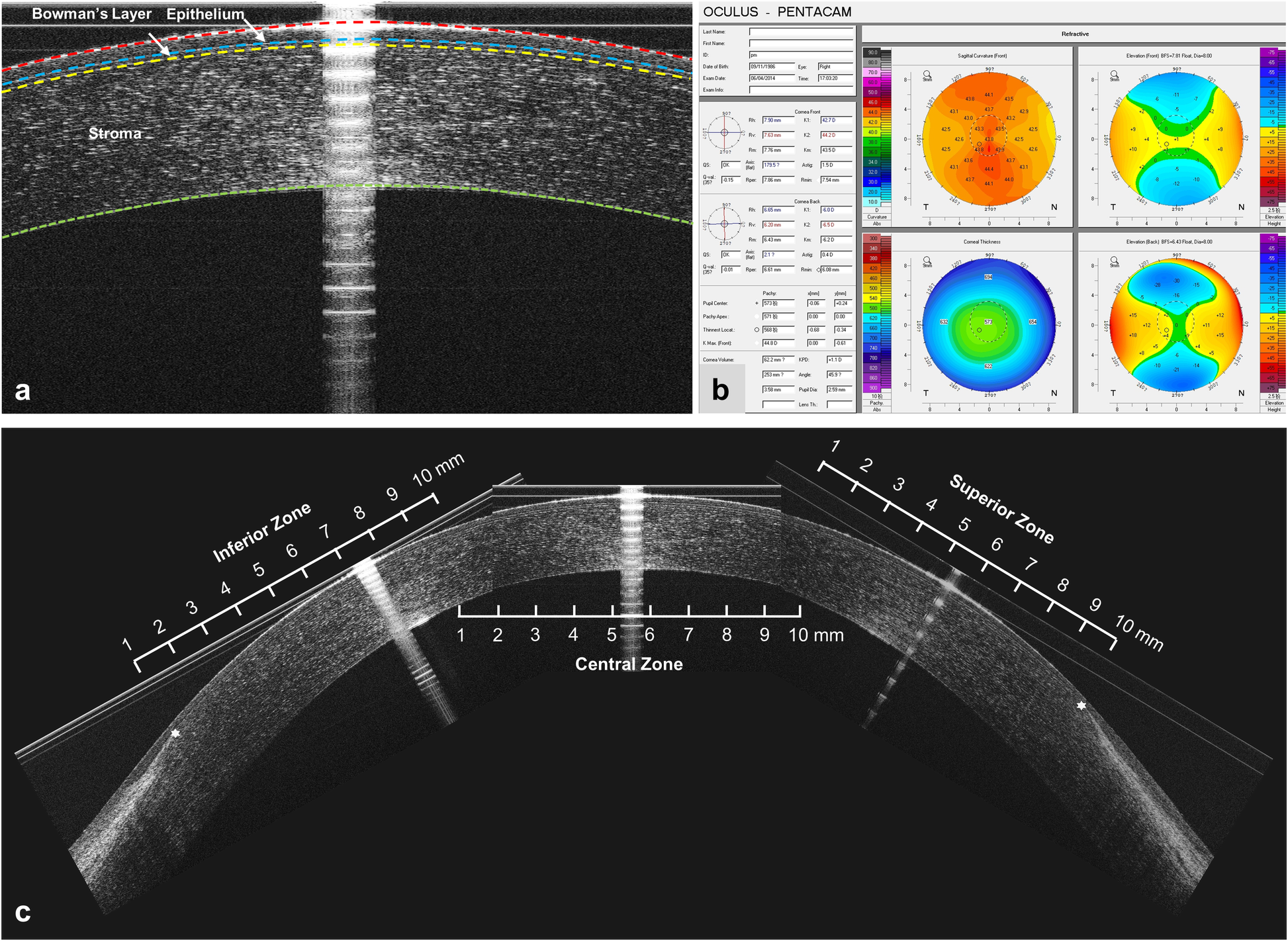 Fig. 1