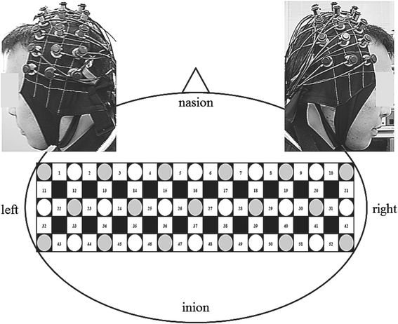 Fig. 2