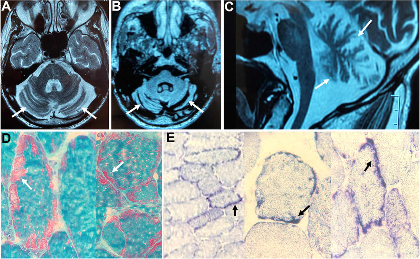 Fig. 1