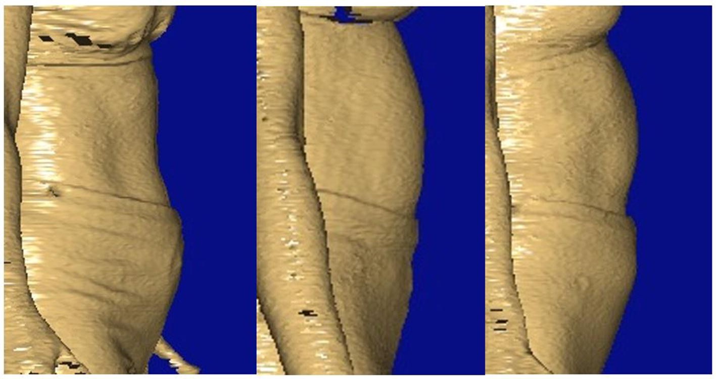 Fig. 11