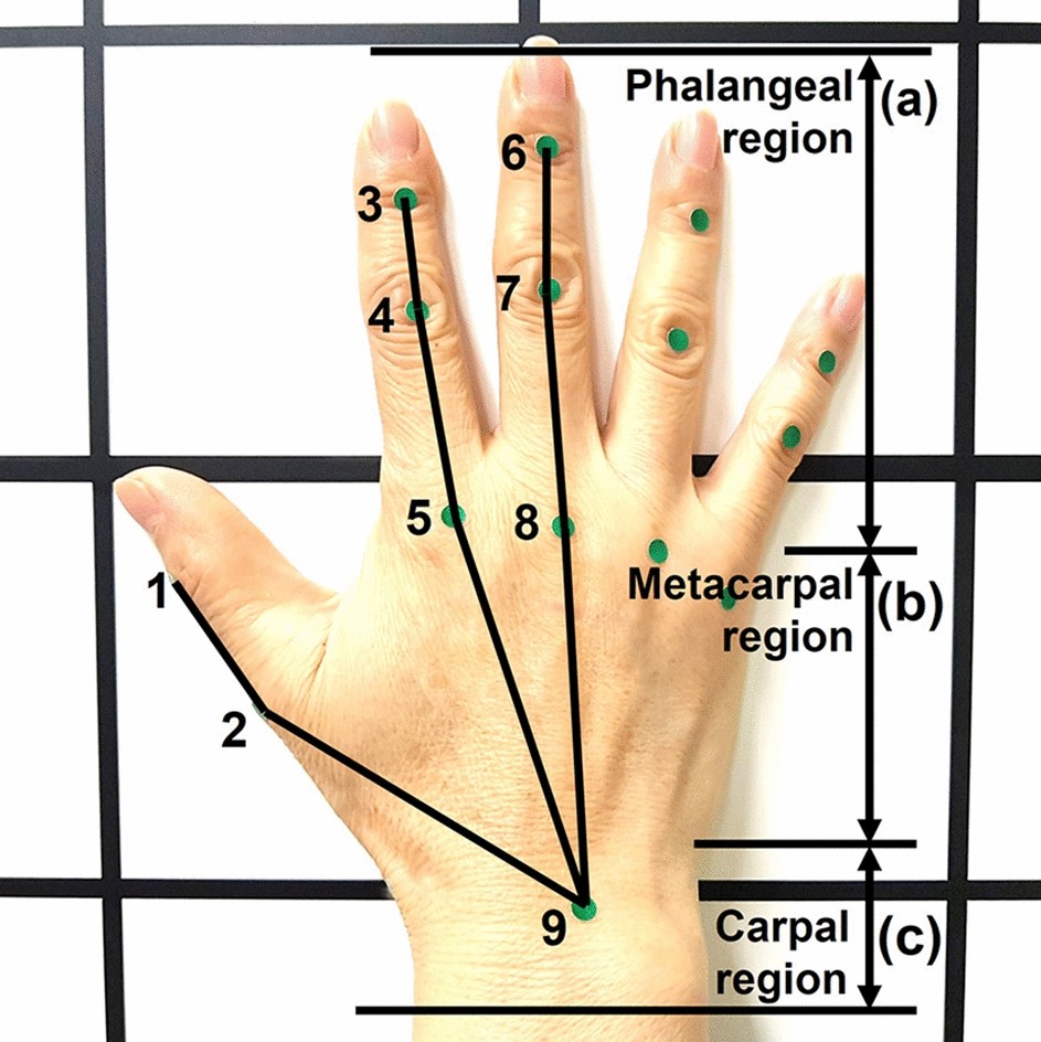 Fig. 1