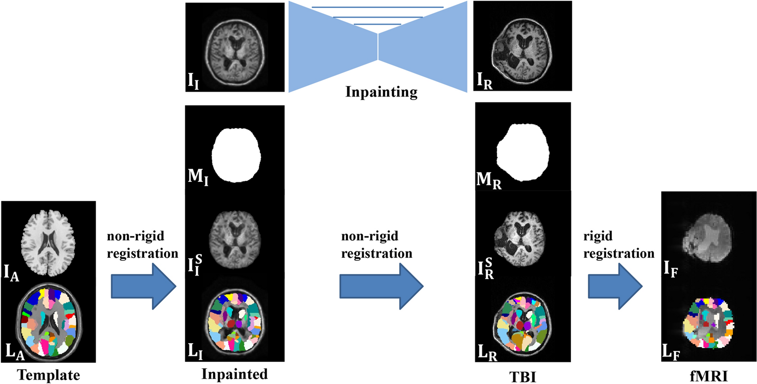 Fig. 2