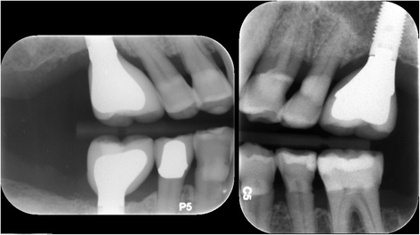 Fig. 11