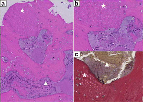 Fig. 17