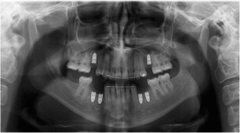 Fig. 6