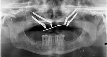 Fig. 13