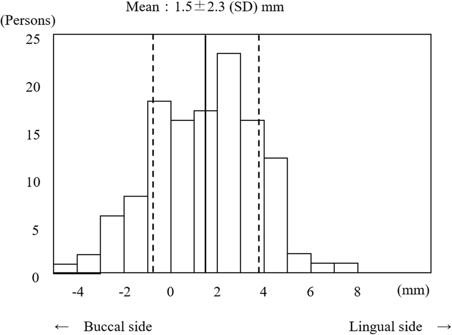 Fig. 11