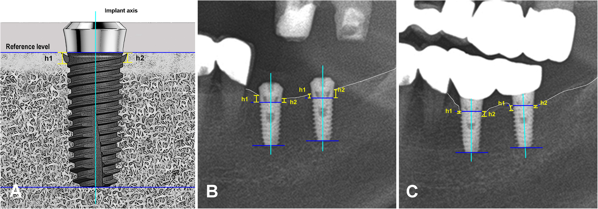 Fig. 3