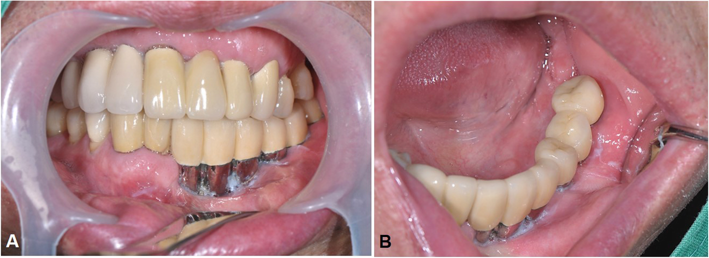 Fig. 7